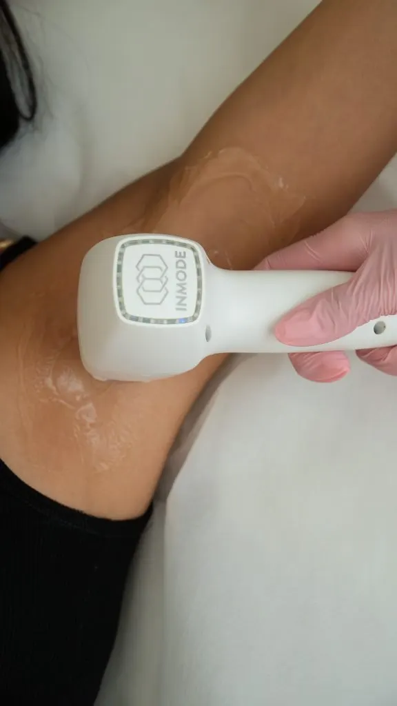 Underarms at Balanced Beauty Med Spa in Vaughan