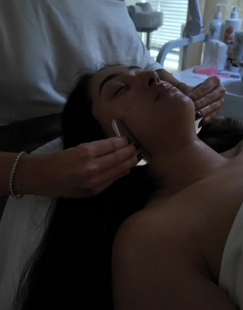 Glycolic Acid Peel (30%) at Balanced Beauty Med Spa in Vaughan