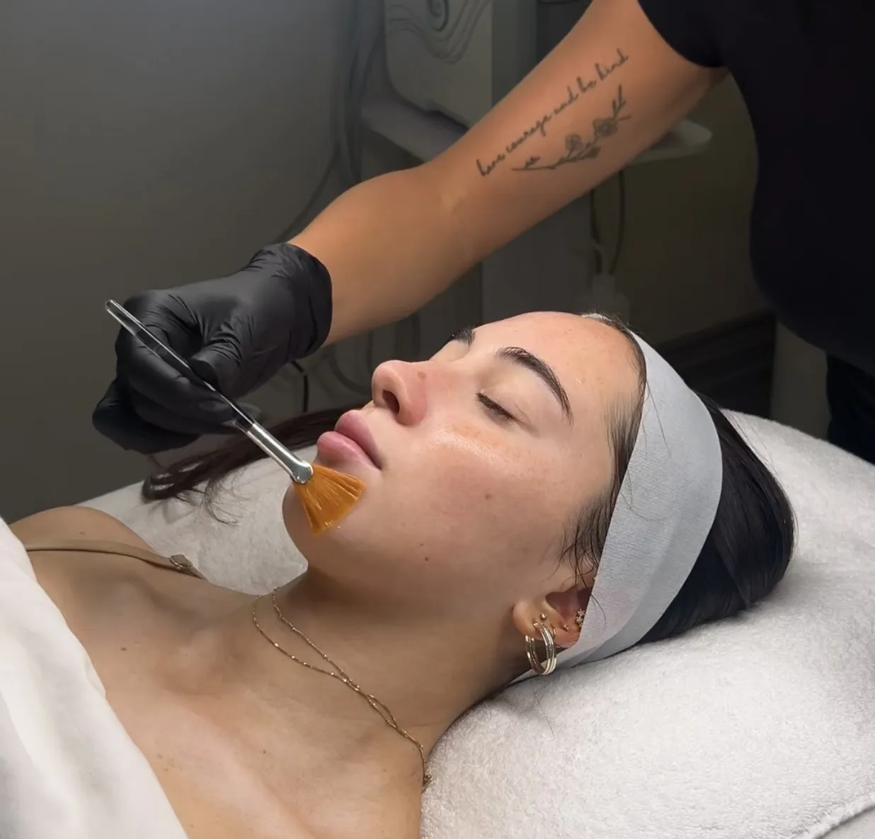 GlyMed AHA No-Downtime Peel at Balanced Beauty Med Spa in Vaughan