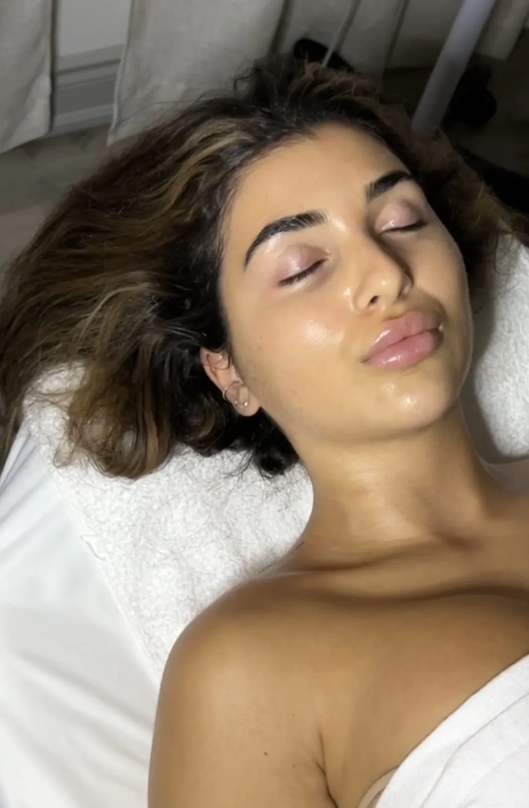 Jessners Peel at Balanced Beauty Med Spa in Vaughan